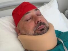 Saobraćajna nesreća na Begaljičkom brdu, povređen biznismen Branko Babić