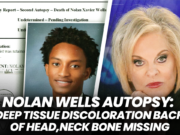 Misteriozna smrt Nolana Wellsa: obdukcija otkriva potamnelost tkiva i nestalu kost vrata Misteriozna smrt Nolana Wellsa: obdukcija otkriva potamnelost tkiva i nestalu kost vrata – obdukcija Nolan Wells