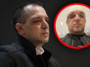 Napad na Zorana Marjanovića u stanu na Novoj, policija traga za napadačem Napad na Zorana Marjanovića u stanu na Novoj, policija traga za napadačem