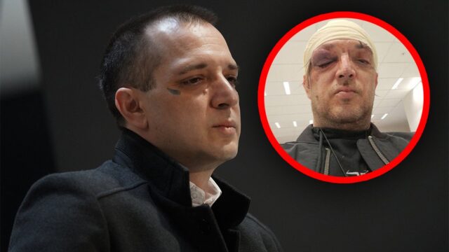 napad-na-zorana Napad na Zorana Marjanovića u stanu na Novoj, policija traga za napadačem