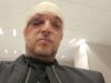Otkriveni detalji napada na Zorana Marjanovića: Do incidenta došlo zbog devojke?! Napad u stanu na Paliluli, Zoran Marjanović povređen tokom incidenta
