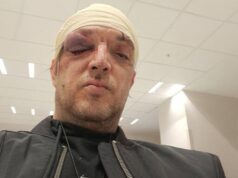 Otkriveni detalji napada na Zorana Marjanovića: Do incidenta došlo zbog devojke?! Napad u stanu na Paliluli, Zoran Marjanović povređen tokom incidenta