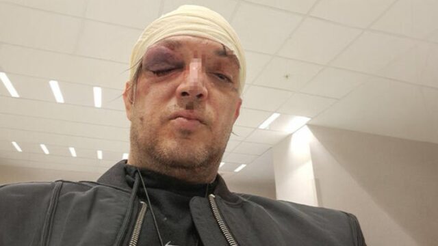 napad-u-stanu Napad u stanu na Paliluli, Zoran Marjanović povređen tokom incidenta